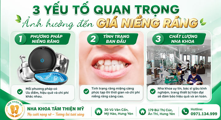 Chi phí niềng răng trung bình hiện nay