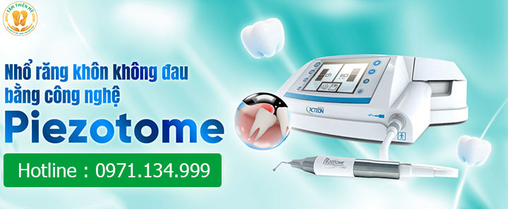 Nhổ răng 8 bằng máy Piezotome