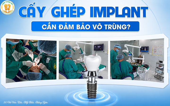 cấy ghép răng Implant