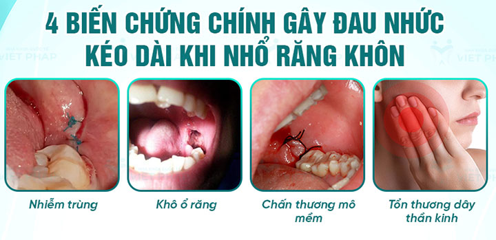 hình ảnh nhổ răng khôn bị nhiễm trùng
