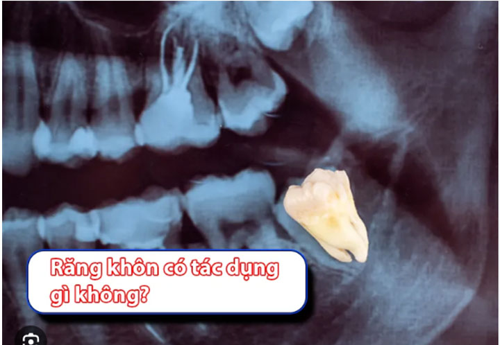 Răng khôn có tác dụng gì