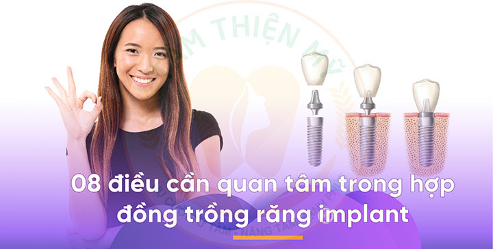 hợp đồng cấy ghép Implant
