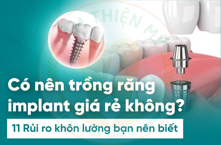 cấy răng implant giá rẻ