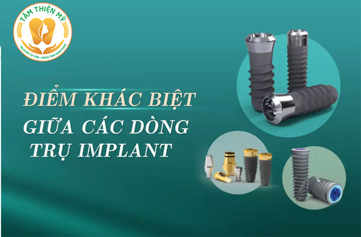 Trụ răng implant nào tốt nhất? Bảng giá các loại trụ Implant MỚI NHẤT 2026 6 Sự khác nhau giữa các dòng trụ Implant