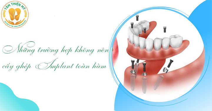 trường hợp không nên cấy implant toàn hàm