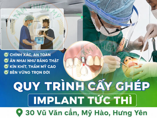 Quy trình cấy ghép implant công nghệ chịu lực tức thì tại Nha khoa Tâm Thiện Mỹ