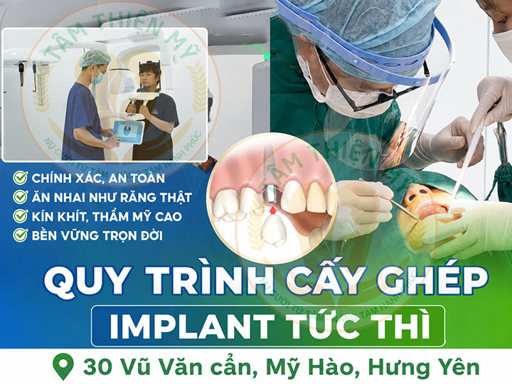Quy trình cấy ghép implant công nghệ chịu lực tức thì tại Nha khoa Tâm Thiện Mỹ