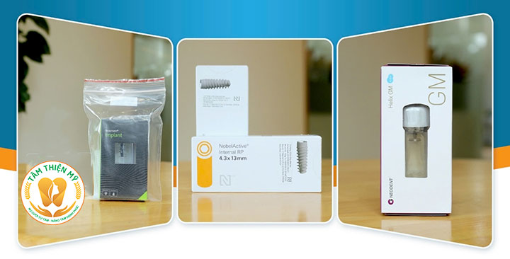 Trụ răng Implant nào tốt nhất