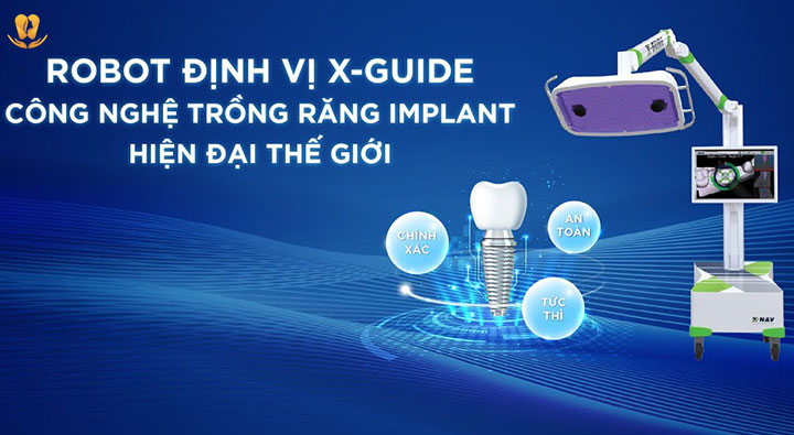 Robot định vị X-Guide