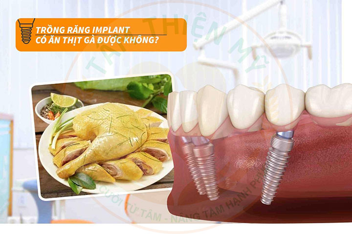 Sau trồng răng Implant kiêng gì và ăn gì? Thực đơn dinh dưỡng 9 Trồng răng Implant có ăn được thịt gà không