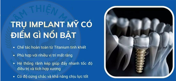 Trụ răng implant nào tốt nhất? Bảng giá các loại trụ Implant MỚI NHẤT 2026 3 Trụ răng Implant của Mỹ