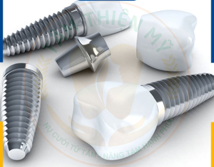 Trụ răng implant nào tốt nhất? Bảng giá các loại trụ Implant MỚI NHẤT 2026 4 trụ implant pháp
