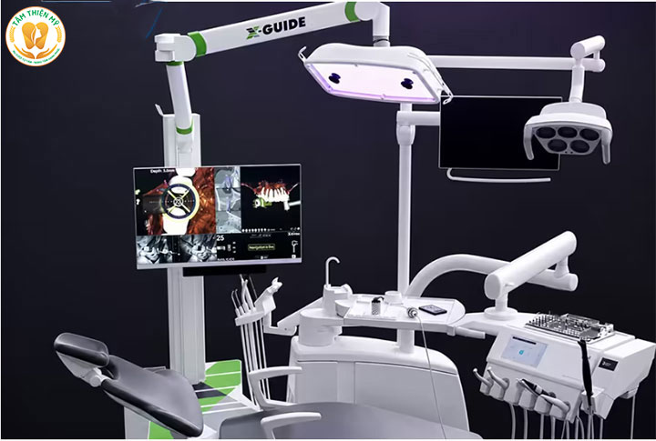 Công nghệ cấy ghép Implant bằng robot X Guide