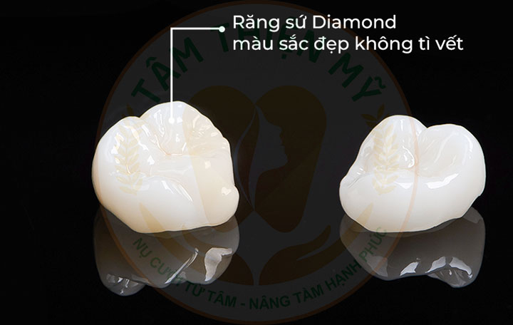Răng sứ Diamond