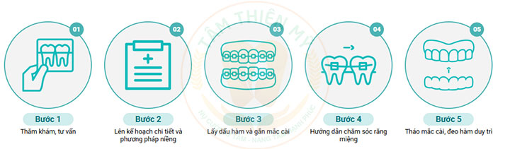 Niềng răng mắc cài kim loại thường giá bao nhiêu? 9 các bước niềng răng mắc cài kim loại