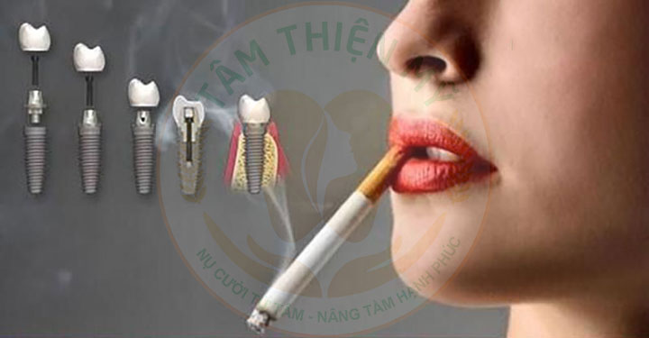Hướng dẫn chế độ chăm sóc răng Implant được bền đẹp trọn đời 6 không hút thuốc lá