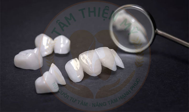 mão răng toàn sứ