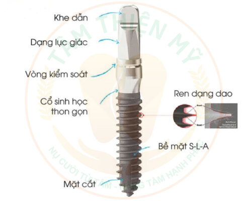cấu tạo mini implant