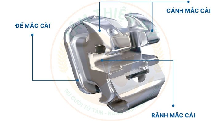 Ưu nhược điểm niềng răng mắc cài kim loại tiêu chuẩn 3 Cấu trúc mắc cài kim loại tiêu chuẩn