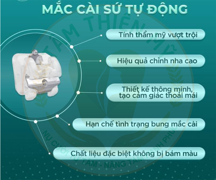 Mắc cài sứ tự buộc là gì? Ưu nhược điểm - chi phí? 5 Ưu điểm niềng răng mắc cài sứ tự động