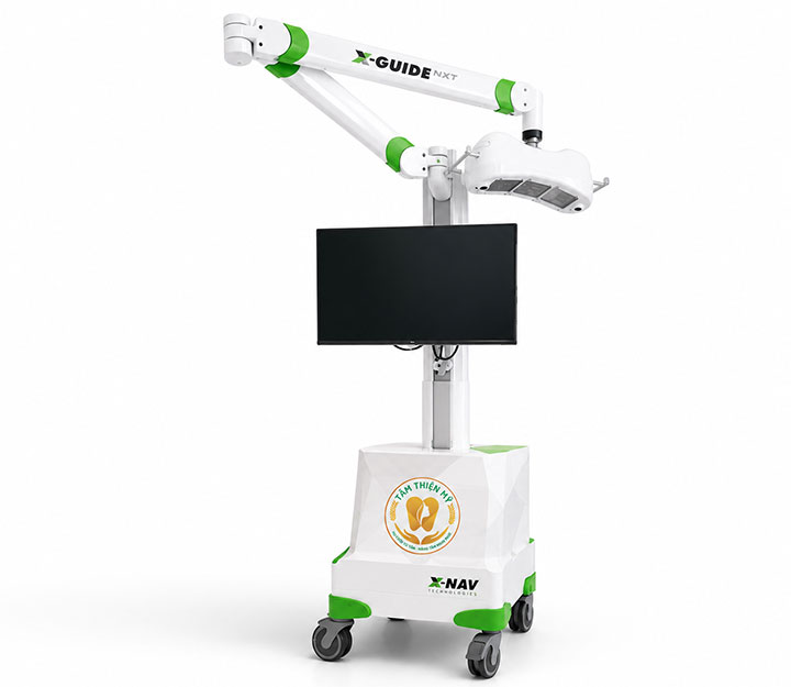 robot định vị X-Guide
