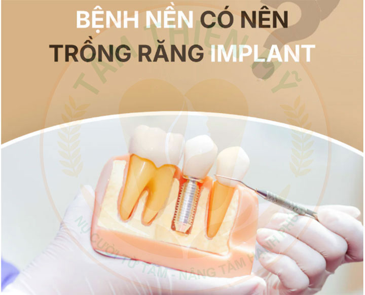 Bệnh lý nền có cấy ghép Implant được không