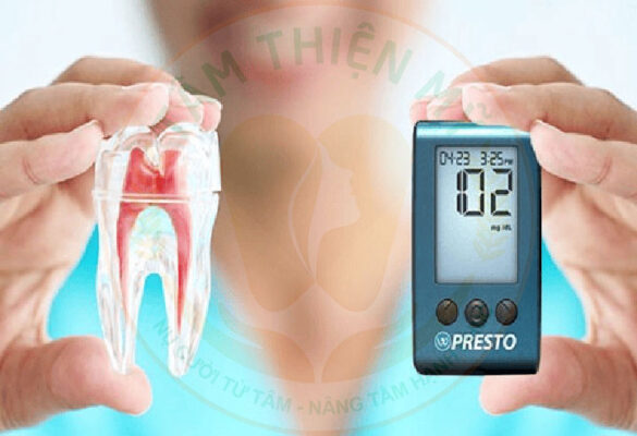 Giải pháp cấy ghép Implant cho bệnh nhân có bệnh nền tại Tâm Thiện Mỹ