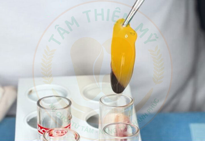 màng PRF trong cấy ghép Implant