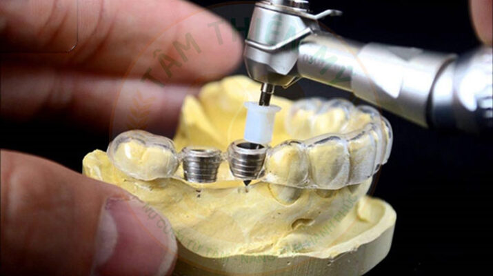 máy khoan đặt trụ Implant
