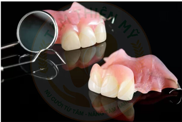 Có nên trồng răng Implant cho trẻ em? Giải pháp cho trẻ em bị mất răng 5 giải pháp hàm tháo lắp cho trẻ bị mất răng