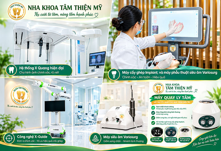 cấy ghép implant cá nhân hóa tại tâm thiện mỹ