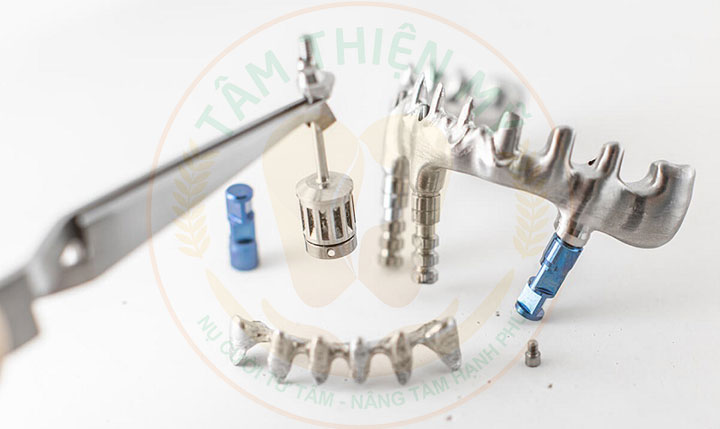 cấy ghép Implant dưới màng xương