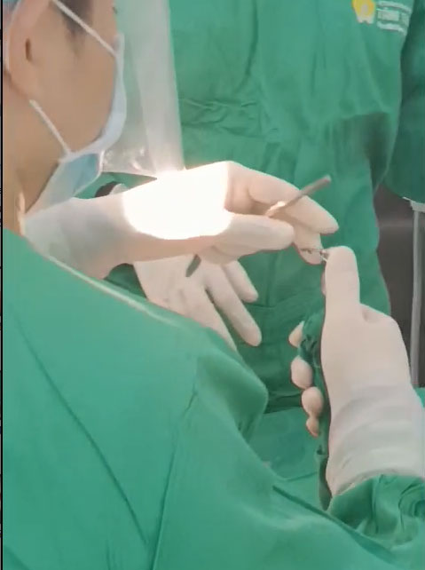 Máy khoan đặt trụ Implant