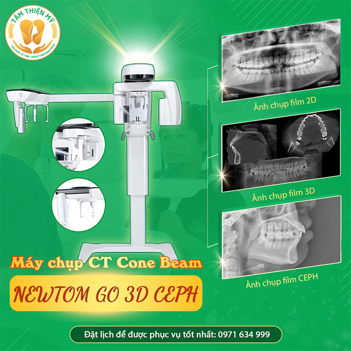 Máy CT Cone Beam 3D - Bước đầu quyết định 1 ca Implant thành công 3 máy CT Cone Beam 3D