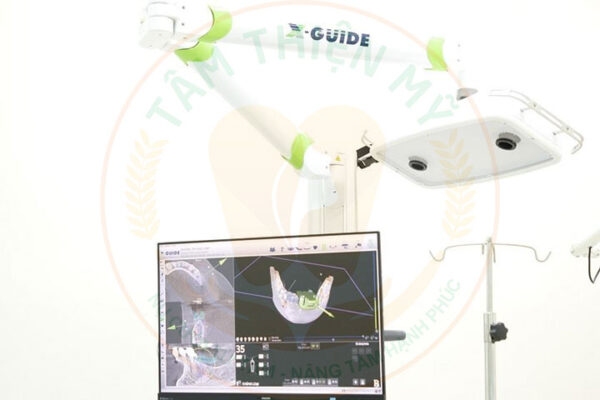 Nha khoa Tâm Thiện Mỹ ứng dụng máy CT Cone Beam 3D trong trồng răng Implant