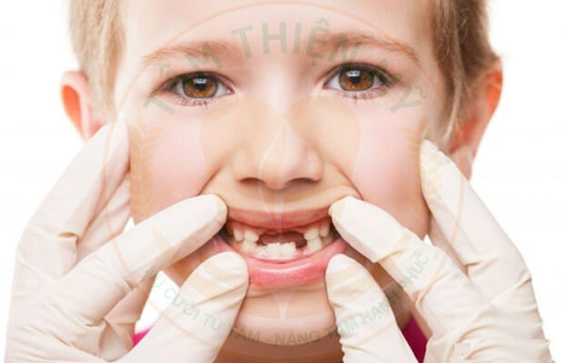 Có nên trồng răng Implant cho trẻ em? Giải pháp cho trẻ em bị mất răng 2 trồng răng Implant cho trẻ em