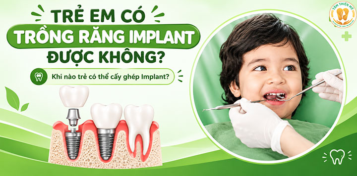 trồng răng Implant cho trẻ em uy tín tại Hưng Yên