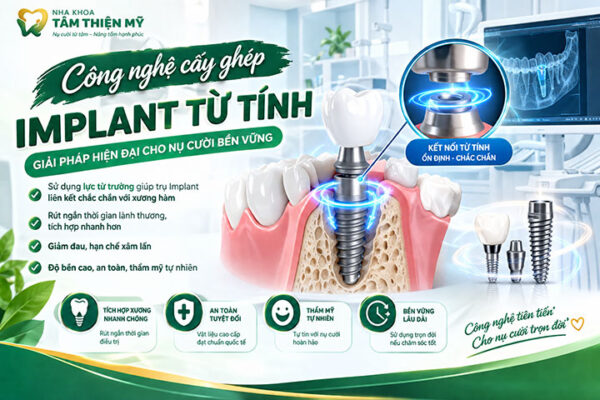 trồng răng implant từ tính