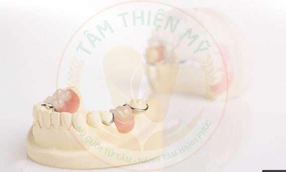 Để mất răng số 7 hàm dưới lâu hậu quả khôn lường 6 hàm tháo lắp răng 7 dưới