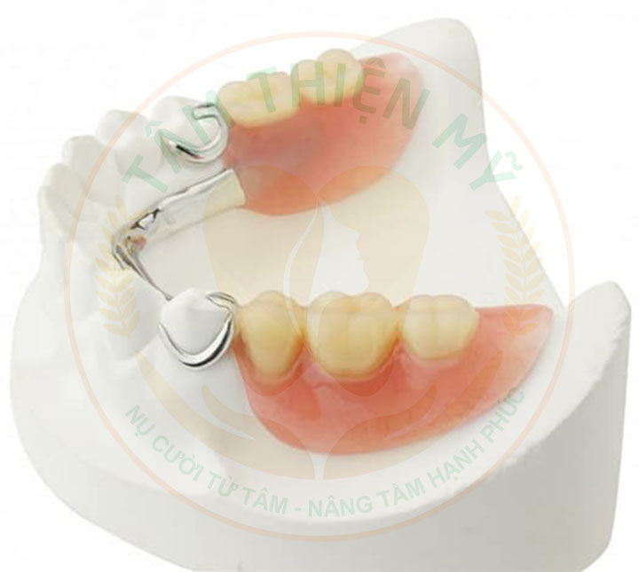 Nguyên nhân và hậu quả khi mất răng số 5- Phục hình răng 5 hiệu 8 Làm hàm giả tháo lắp phục hình răng 5