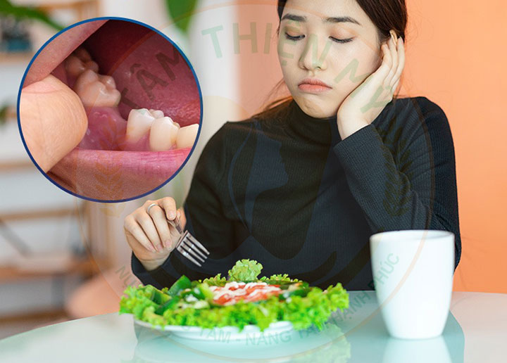Mất răng 5 bị tiêu xương hàm có cắm được Implant không? 4 Mất răng 5 bị tiêu xương hàm