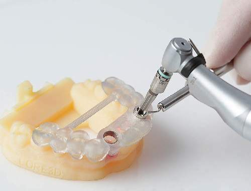 Máng hướng dẫn phẫu thuật Implant