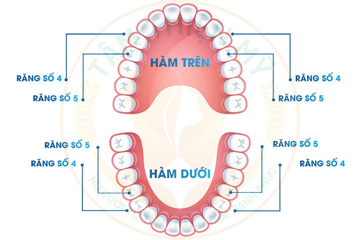 vị trí răng số 4